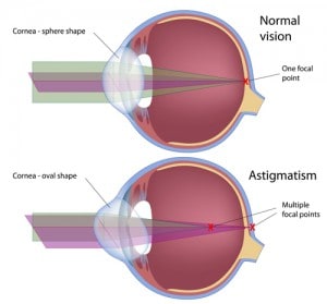 Gulfcoast Eyecare Schedule Consultation