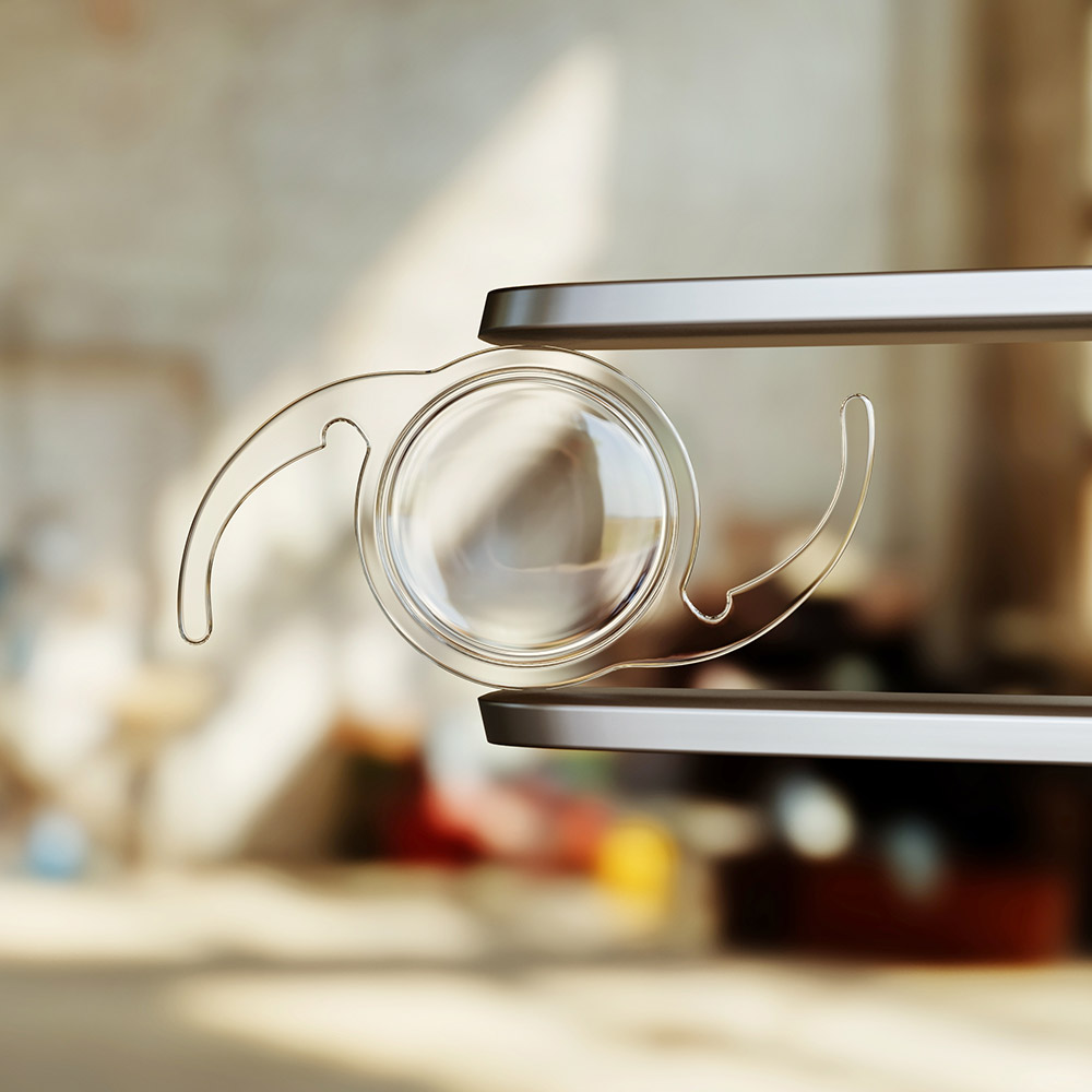 Close-up of a clear intraocular lens (IOL) held by surgical tools, used to replace cloudy lenses in cataract surgery.